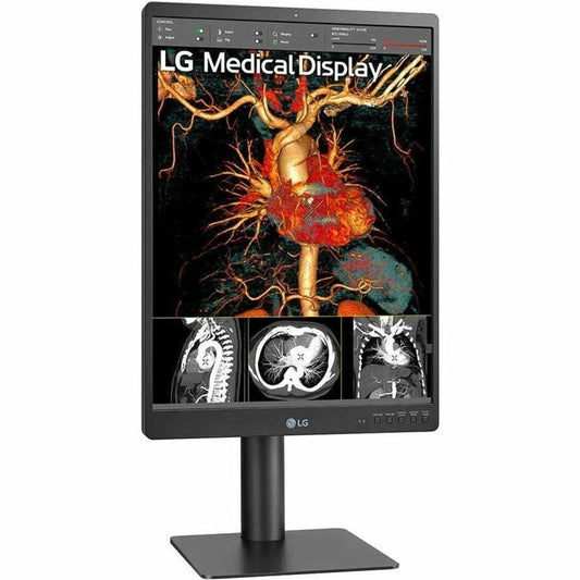 LG 21HQ513D-S 21" Healthcare LCD Monitor, QXGA IPS Display, 1100 Nit Brightness, Integrated Front Sensor, Height/Tilt/Pivot Adjustable, 3 DisplayPorts, USB Hub, RoHS Compliant - 21HQ513D-S (1 Year Warranty)
