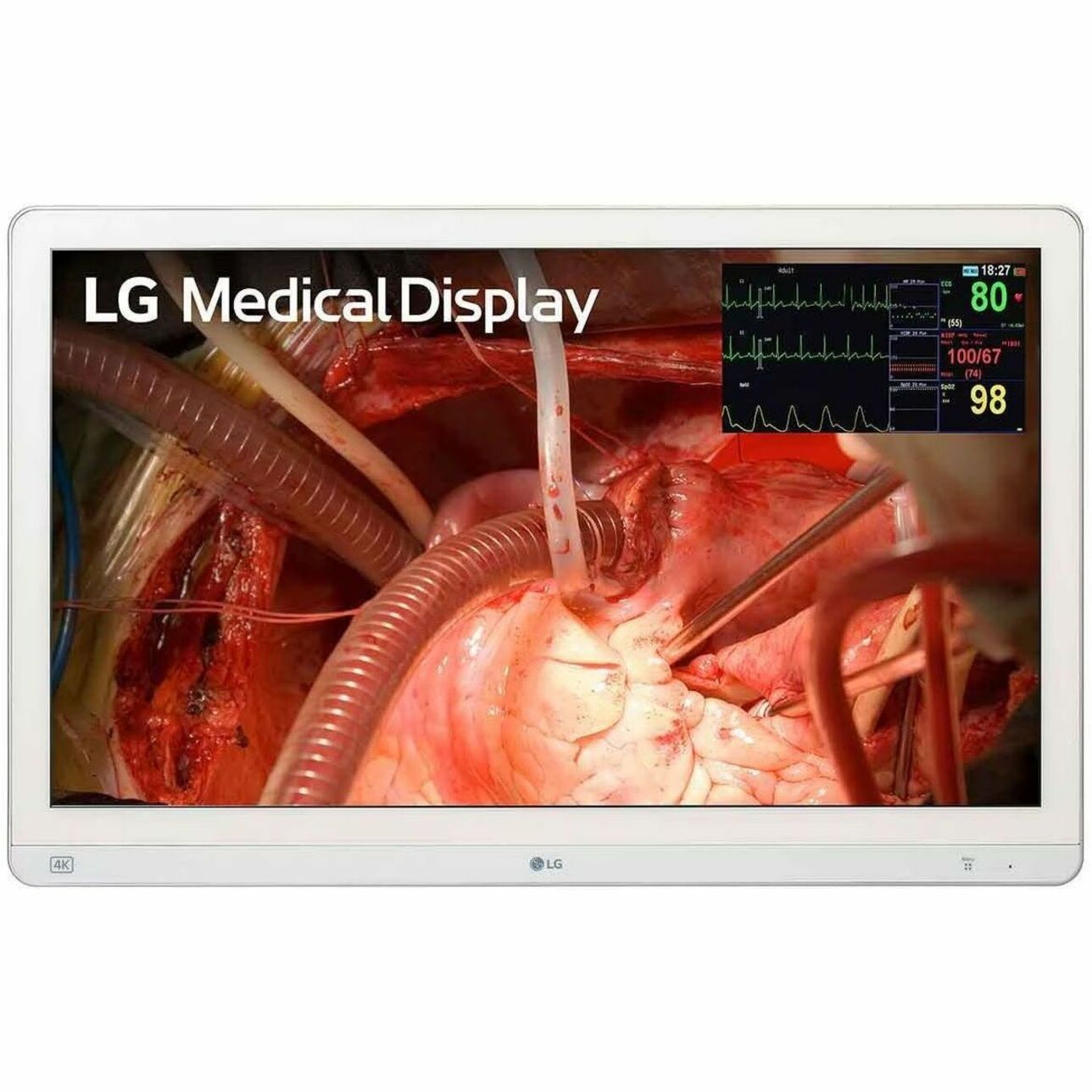 LG 27HQ710S-W 27-inch 4K UHD LCD Monitor, VA Panel, 3840x2160 Resolution, DVI & HDMI Ports, sRGB, White - 27HQ710S-W (1 Year Warranty)