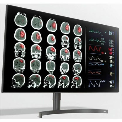 LG 32HQ713D-B 31.5" 4K UHD IPS LCD Monitor, 1000 Nit Brightness, 100% sRGB Color, USB Hub, DisplayPort, Ergonomic Stand, Anti-glare, Wall Mountable - 32HQ713DB (1 Year Warranty)