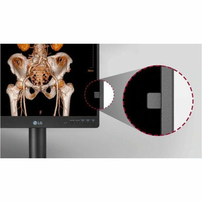 LG 21HQ513D-S 21" Healthcare LCD Monitor, QXGA IPS Display, 1100 Nit Brightness, Integrated Front Sensor, Height/Tilt/Pivot Adjustable, 3 DisplayPorts, USB Hub, RoHS Compliant - 21HQ513D-S (1 Year Warranty)