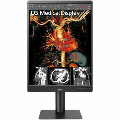 LG 21HQ513D-S 21" Healthcare LCD Monitor, QXGA IPS Display, 1100 Nit Brightness, Integrated Front Sensor, Height/Tilt/Pivot Adjustable, 3 DisplayPorts, USB Hub, RoHS Compliant - 21HQ513D-S (1 Year Warranty)