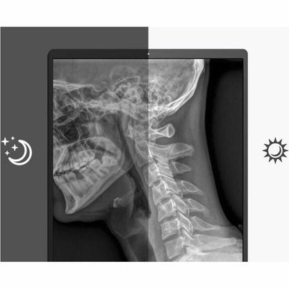 LG 21HQ513D-S 21" Healthcare LCD Monitor, QXGA IPS Display, 1100 Nit Brightness, Integrated Front Sensor, Height/Tilt/Pivot Adjustable, 3 DisplayPorts, USB Hub, RoHS Compliant - 21HQ513D-S (1 Year Warranty)