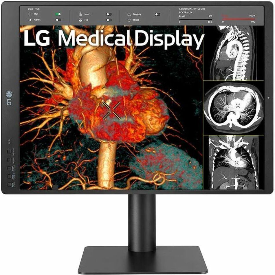 LG 21HQ513D-S 21" Healthcare LCD Monitor, QXGA IPS Display, 1100 Nit Brightness, Integrated Front Sensor, Height/Tilt/Pivot Adjustable, 3 DisplayPorts, USB Hub, RoHS Compliant - 21HQ513D-S (1 Year Warranty)
