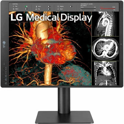 LG 21HQ513D-S 21" Healthcare LCD Monitor, QXGA IPS Display, 1100 Nit Brightness, Integrated Front Sensor, Height/Tilt/Pivot Adjustable, 3 DisplayPorts, USB Hub, RoHS Compliant - 21HQ513D-S (1 Year Warranty)