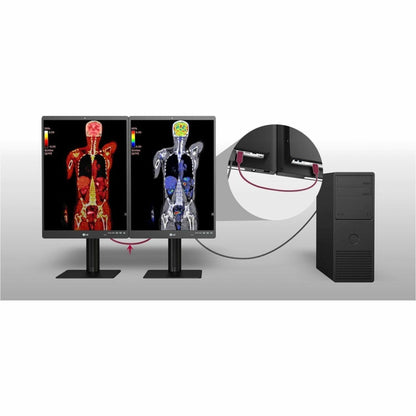 LG 21HQ513D-S 21" Healthcare LCD Monitor, QXGA IPS Display, 1100 Nit Brightness, Integrated Front Sensor, Height/Tilt/Pivot Adjustable, 3 DisplayPorts, USB Hub, RoHS Compliant - 21HQ513D-S (1 Year Warranty)