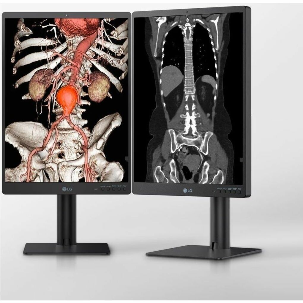 LG 21HQ513D-S 21" Healthcare LCD Monitor, QXGA IPS Display, 1100 Nit Brightness, Integrated Front Sensor, Height/Tilt/Pivot Adjustable, 3 DisplayPorts, USB Hub, RoHS Compliant - 21HQ513D-S (1 Year Warranty)