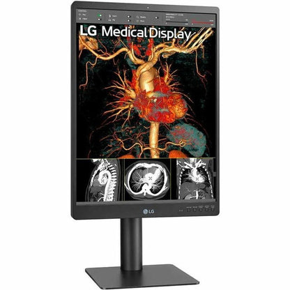 LG 21HQ513D-S 21" Healthcare LCD Monitor, QXGA IPS Display, 1100 Nit Brightness, Integrated Front Sensor, Height/Tilt/Pivot Adjustable, 3 DisplayPorts, USB Hub, RoHS Compliant - 21HQ513D-S (1 Year Warranty)